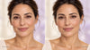 How to Soften Smile Lines: What Dermatologists Say Actually Helps